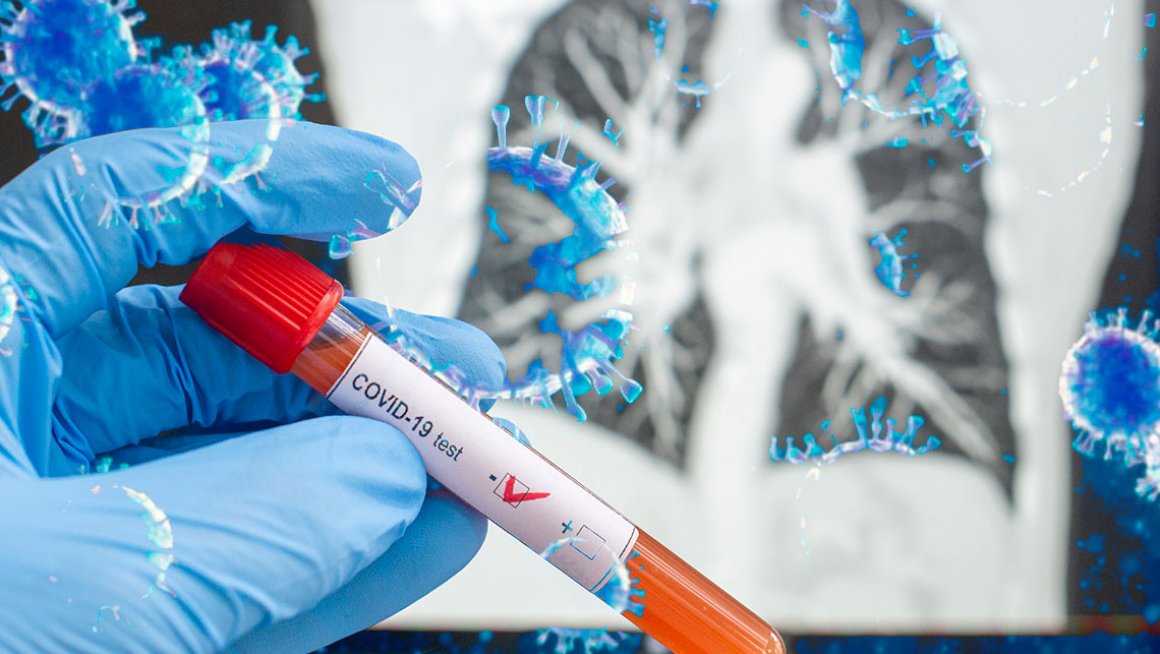 У Геронтолошком центру Ниш тестирано 25 корисника